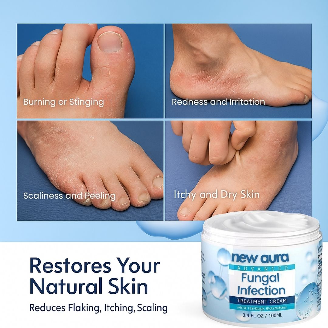 NewAura™ Fungus Cream