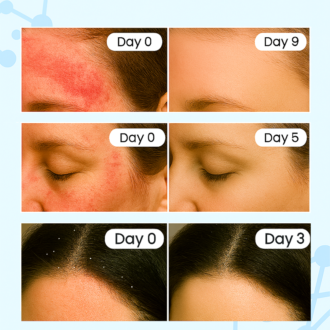 New Aura™ Anti-Fungal Scalp Balm